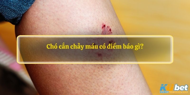 Chó cắn chảy máu có điềm báo gì?